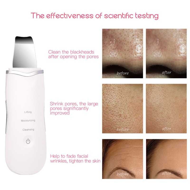 Skin Spatula Ultrasonic Exfoliator