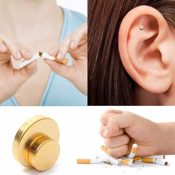 Auricular Therapy Magnets Quit Smoking