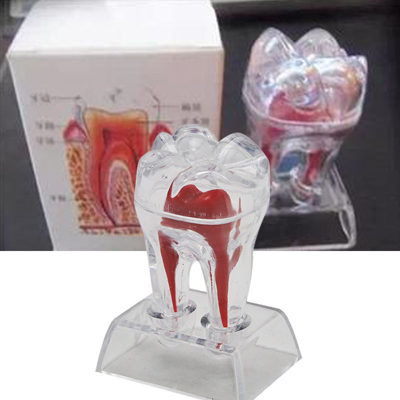 Tooth Model with Crystal Stand