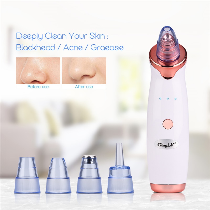 Blackhead Extractor Vacuum Face Suction