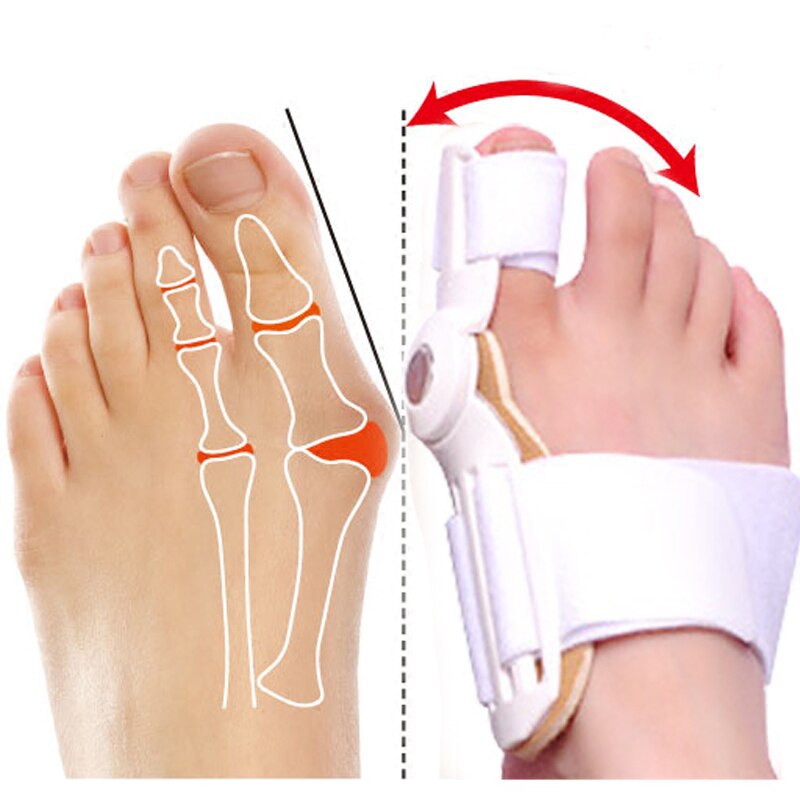 Toe Corrector Orthopedic Bone Straightener