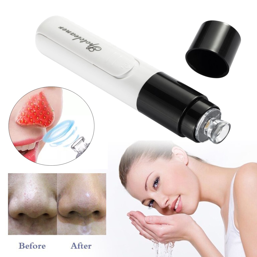 Pore Sucker Suction Blackhead Remover