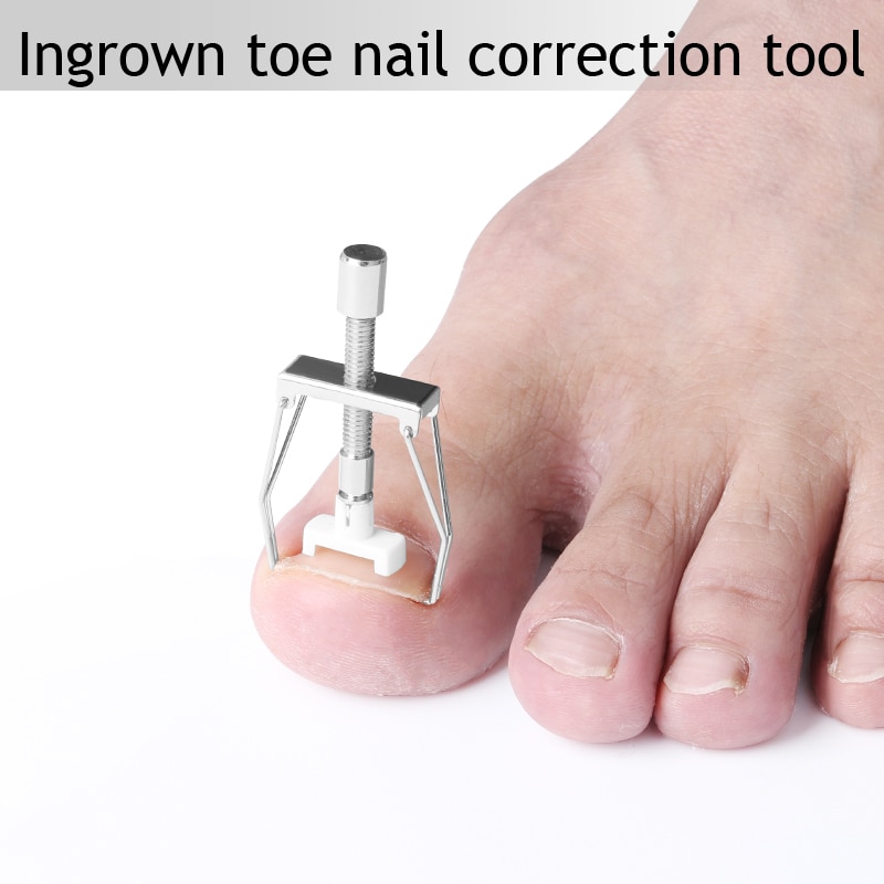 Toenail Corrector Ingrown Fixer Tool