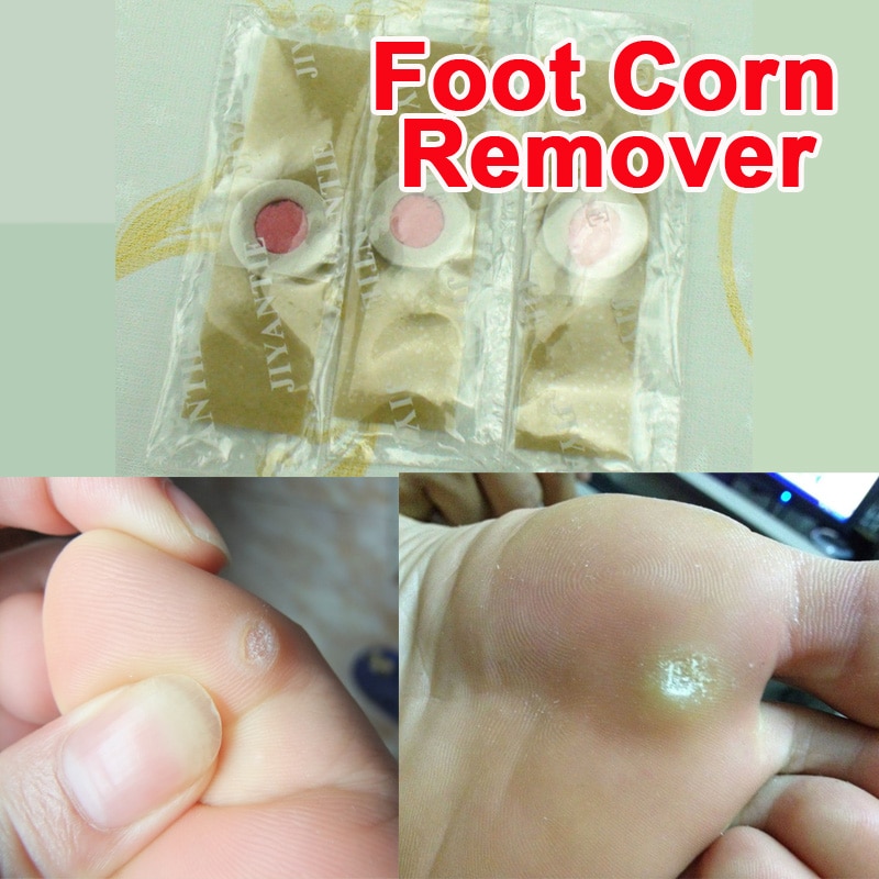 Corn Removal Plaster 24-Patch Pack