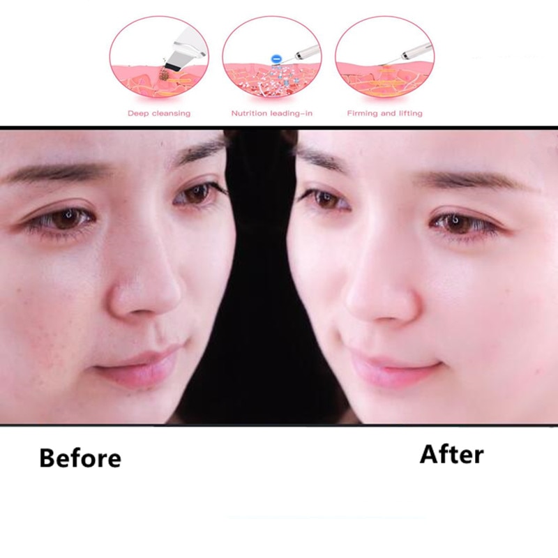 Ultrasonic Face Cleaner and Face Massage