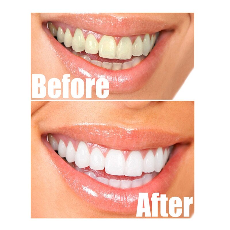 Teeth Whitening Powder Dental Care