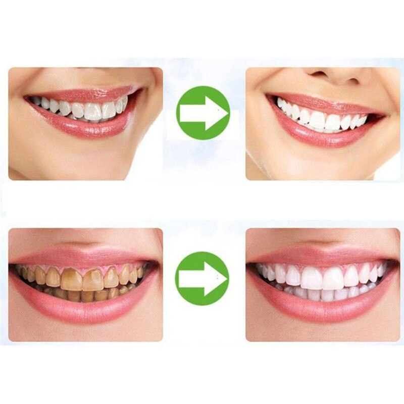 Teeth Whitening Powder Dental Care