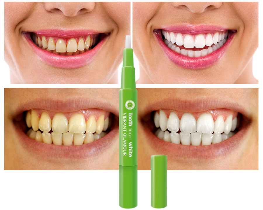 Teeth Whitening Pen Stain Remover