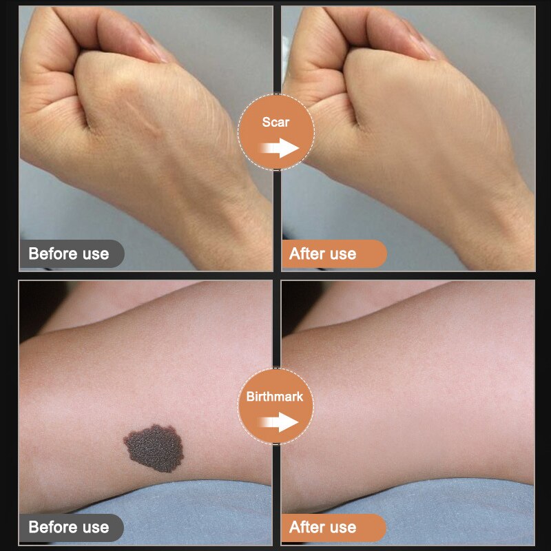 Tattoo Concealer Birthmark Make-up Covering