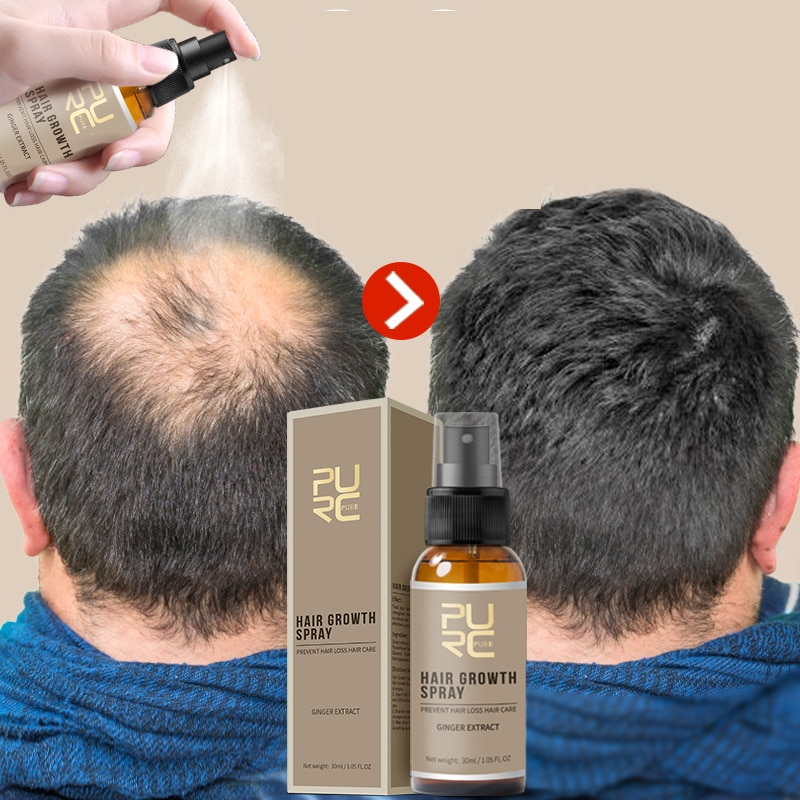 Hair Growth Spray Hair Loss Treatment