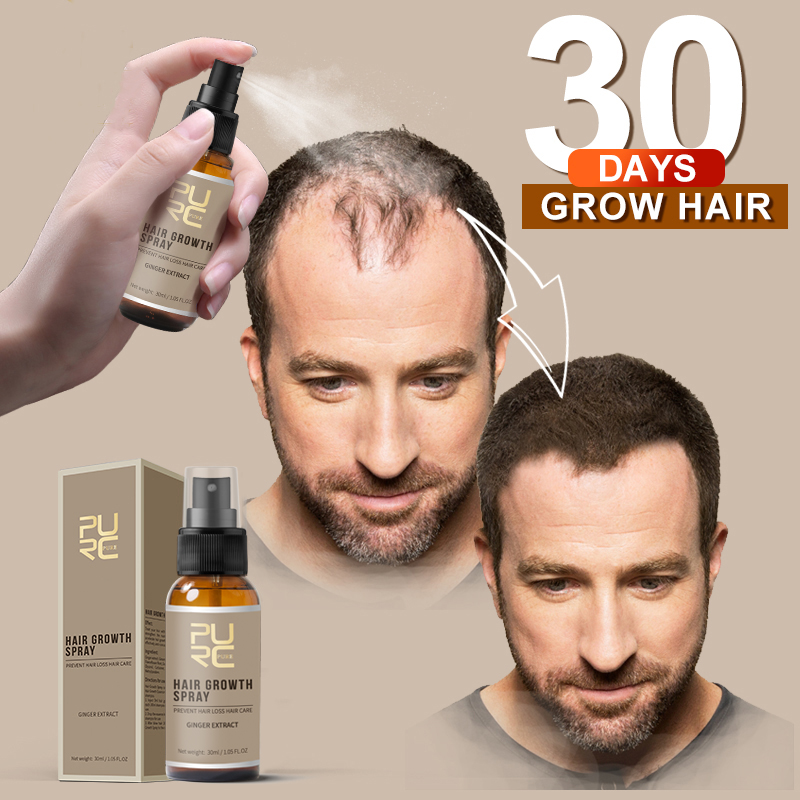 Hair Growth Spray Hair Loss Treatment