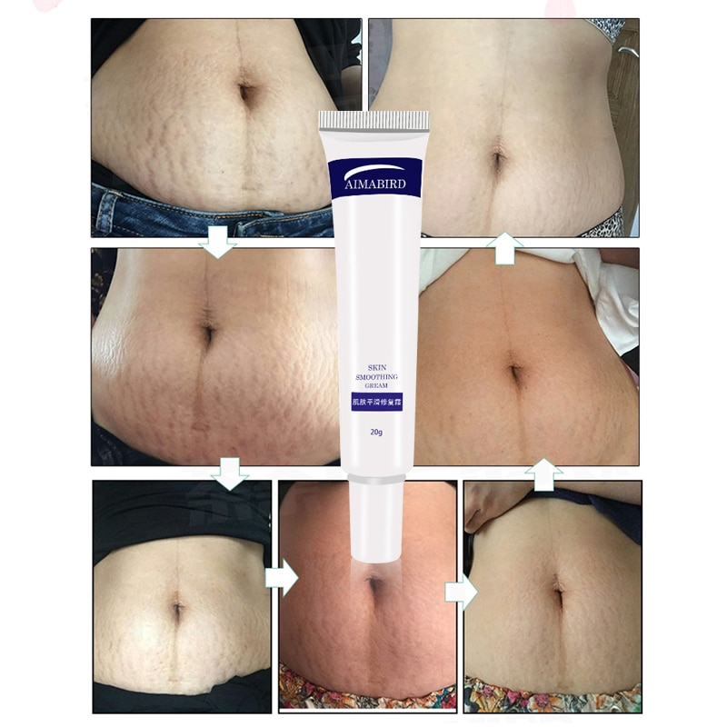 Stretch Mark Cream Skin Repair