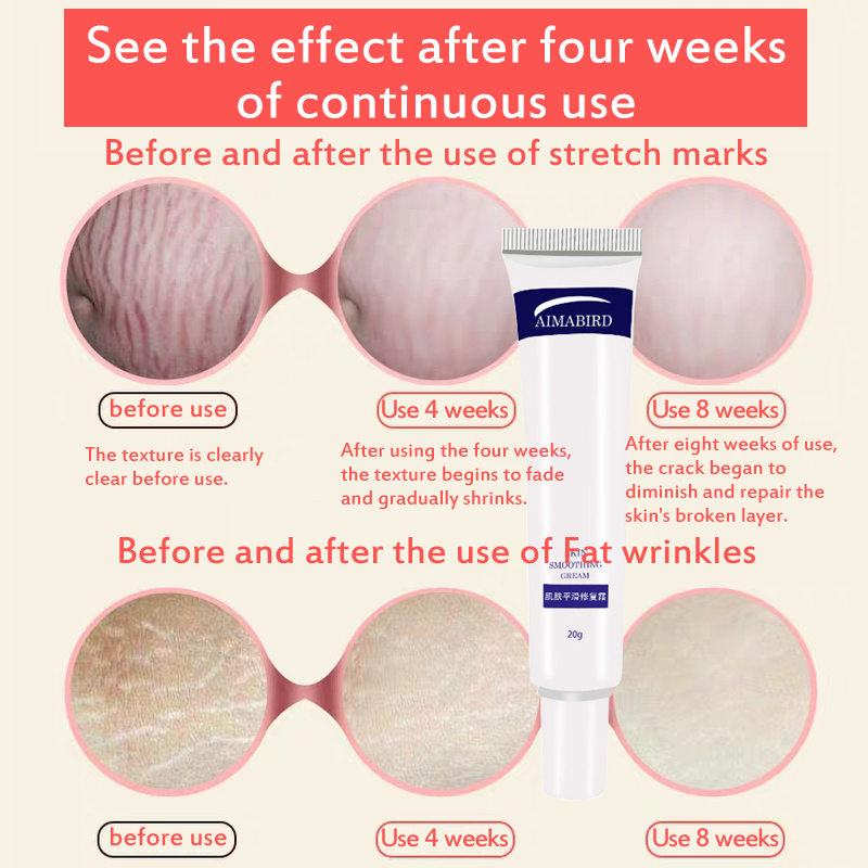 Stretch Mark Cream Skin Repair