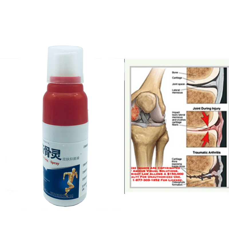 Pain Relief Spray Body Pain Reliever