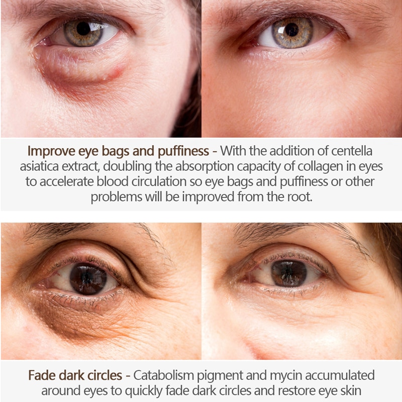 Firming Eye Cream Wrinkle Treatment