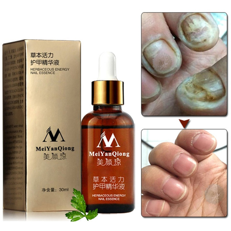 Topical Antifungal Nail Care Oil