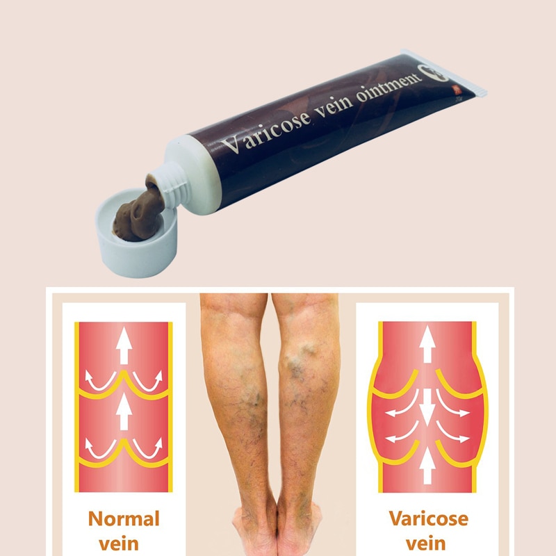 Varicose Veins Cream Ointment