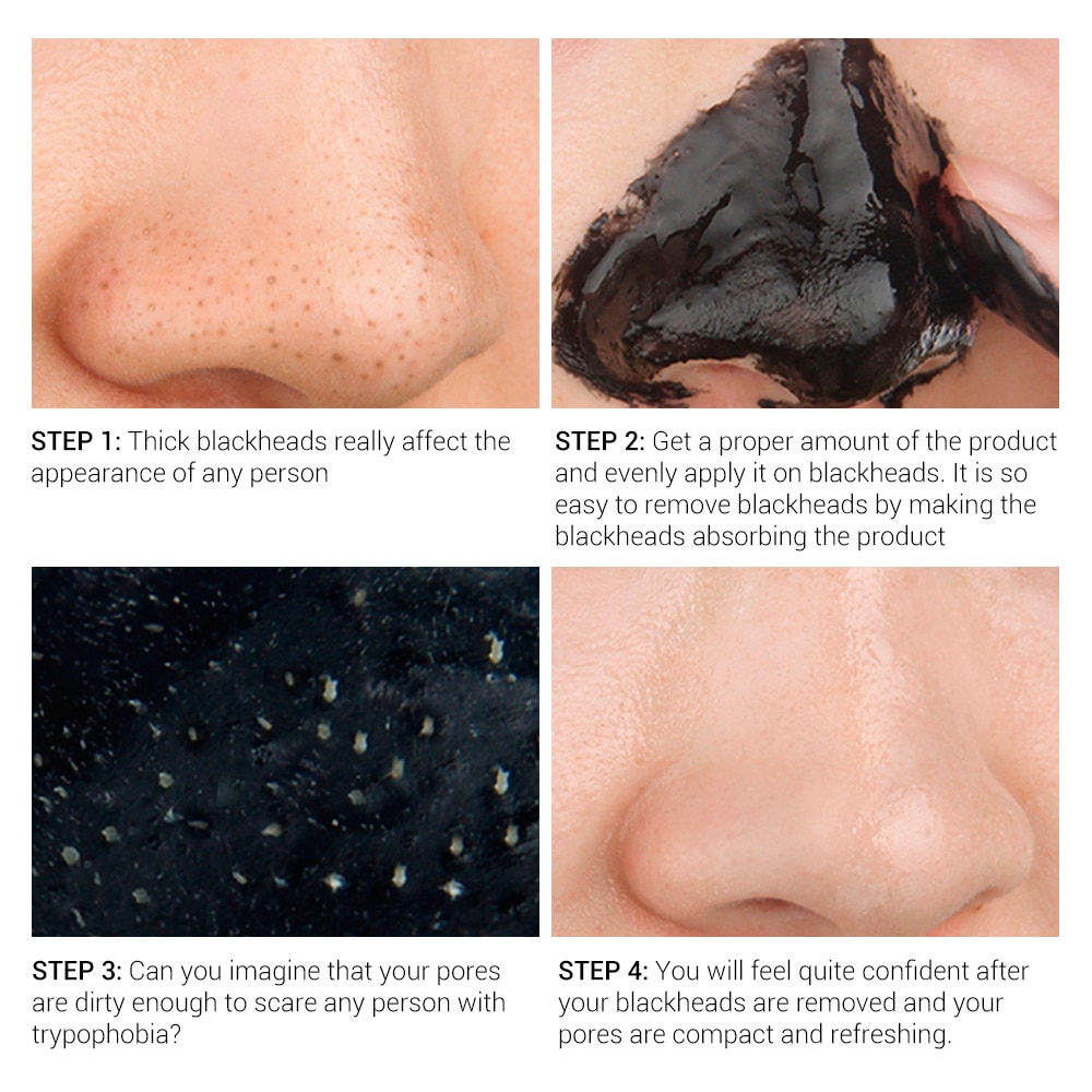 Blackhead Removal Mask Treatment