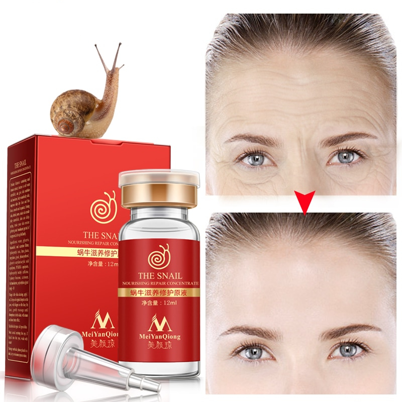 Skin Serum Anti-Acne Snail Concentrate