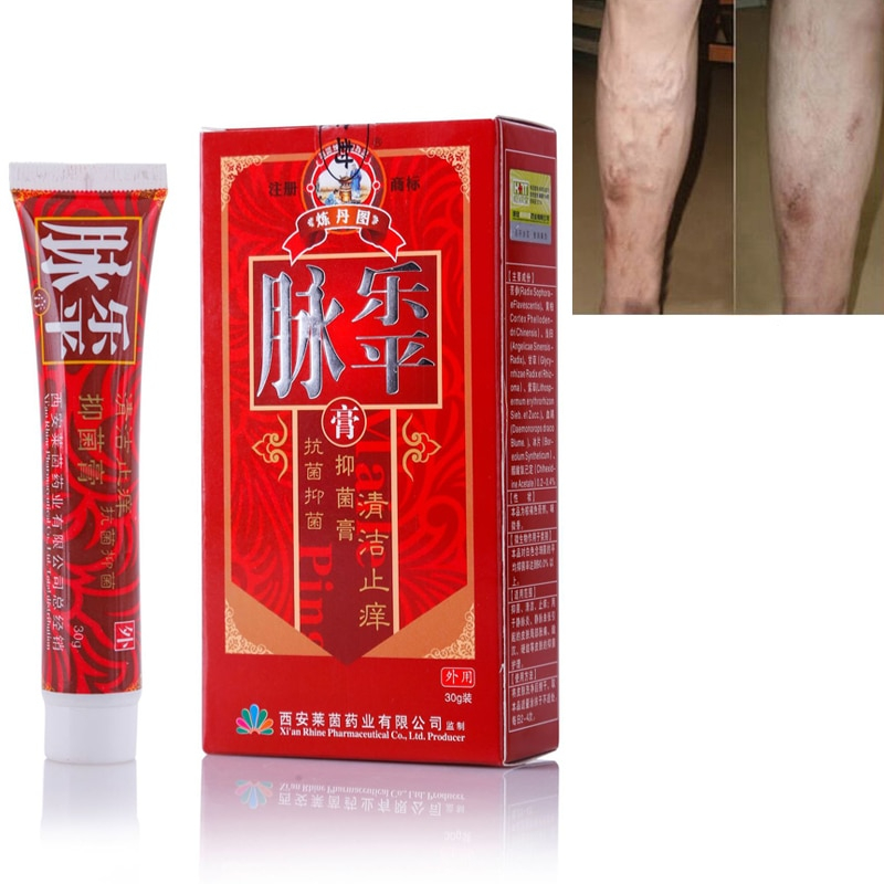 Varicose Veins Treatment Cream Herbal Formula