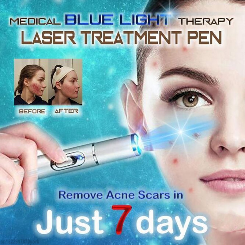 Blue Light Therapy Treatment Pen