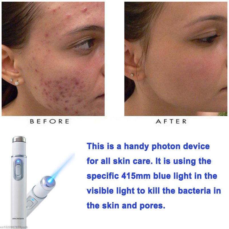 Blue Light Therapy Treatment Pen