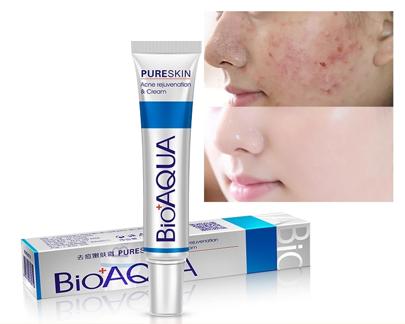 Acne Treatment BioAqua Skin Healer