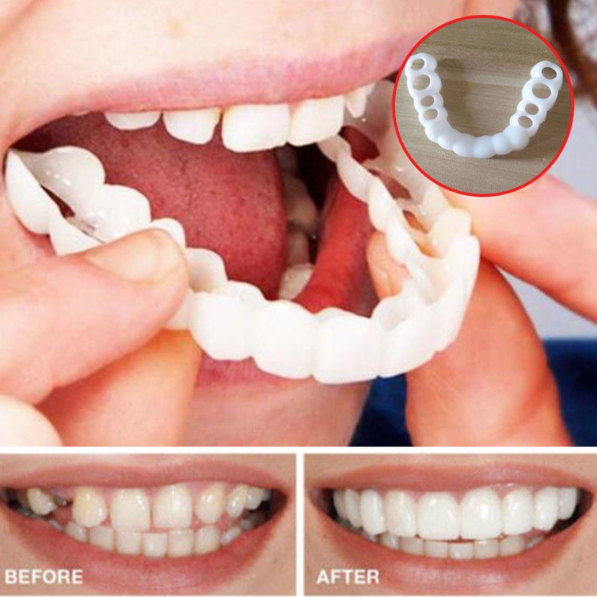 Dental Veneers Teeth Caps