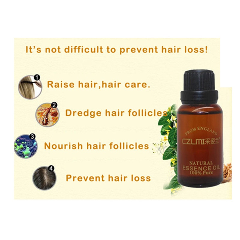 Alopecia Hair Loss Treatment