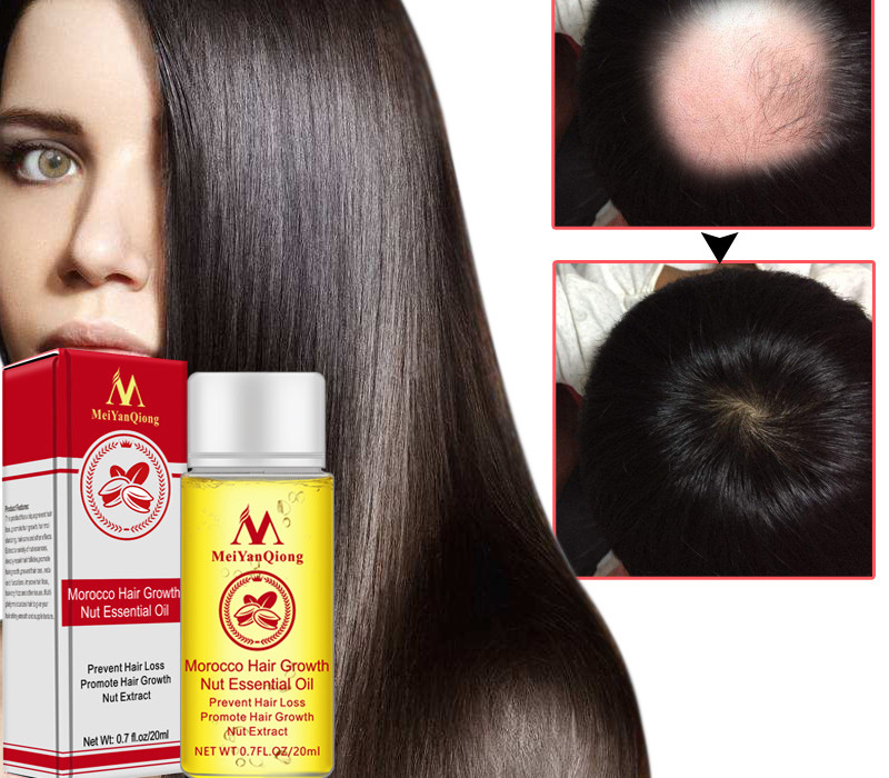 Hair Growth Serum Natural Treatment