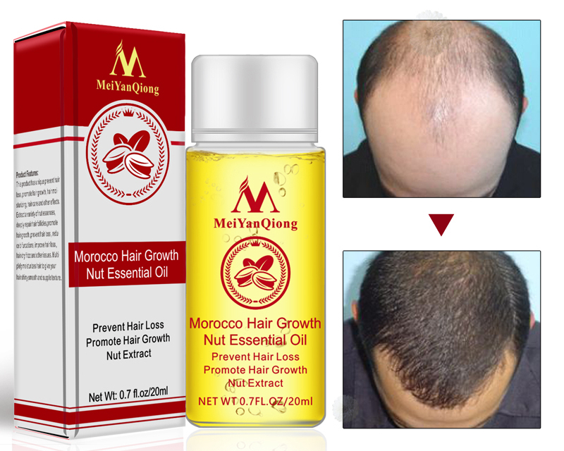 Hair Growth Serum Natural Treatment