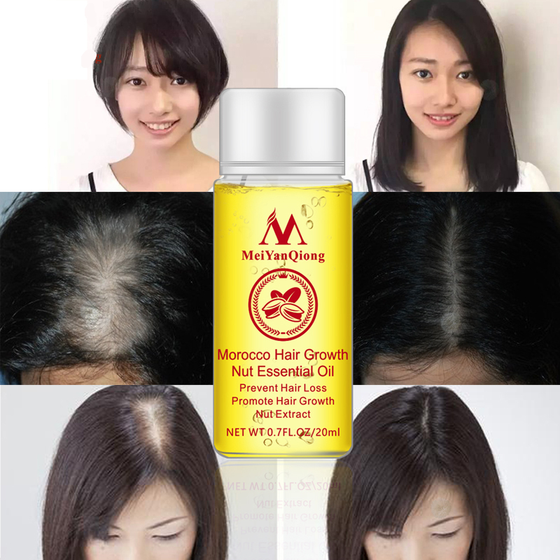 Hair Growth Serum Natural Treatment