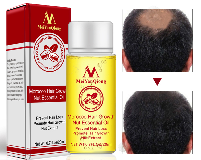 Hair Growth Serum Natural Treatment