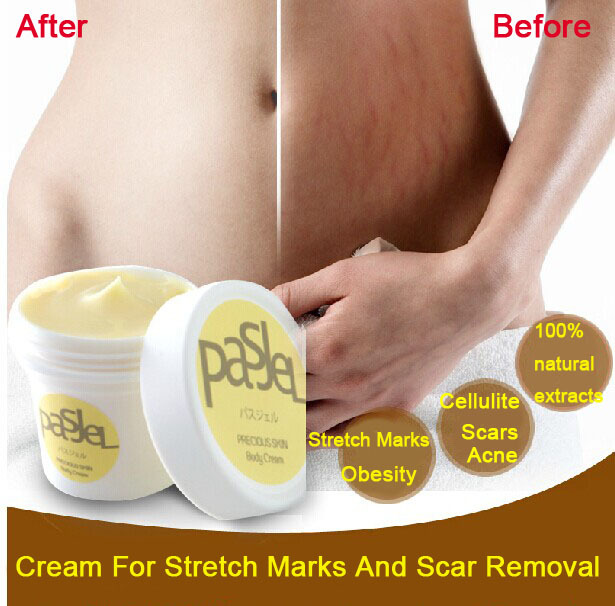 Stretchmark Removal Cream