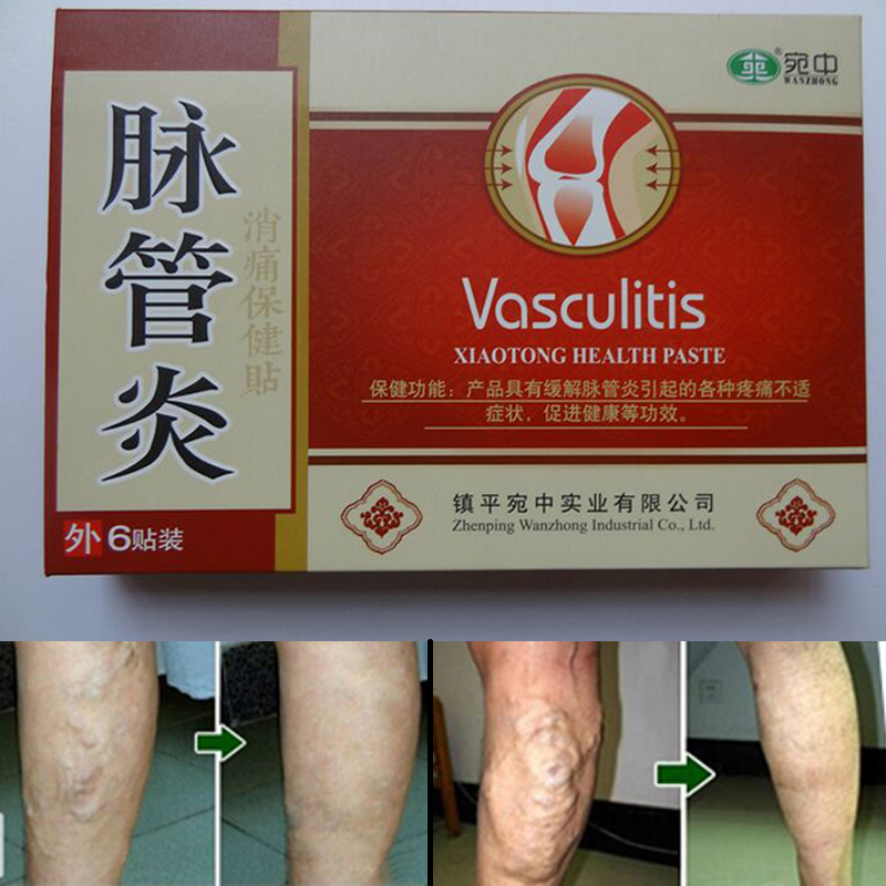 Varicose Veins Treatment Plaster (Set of 24)