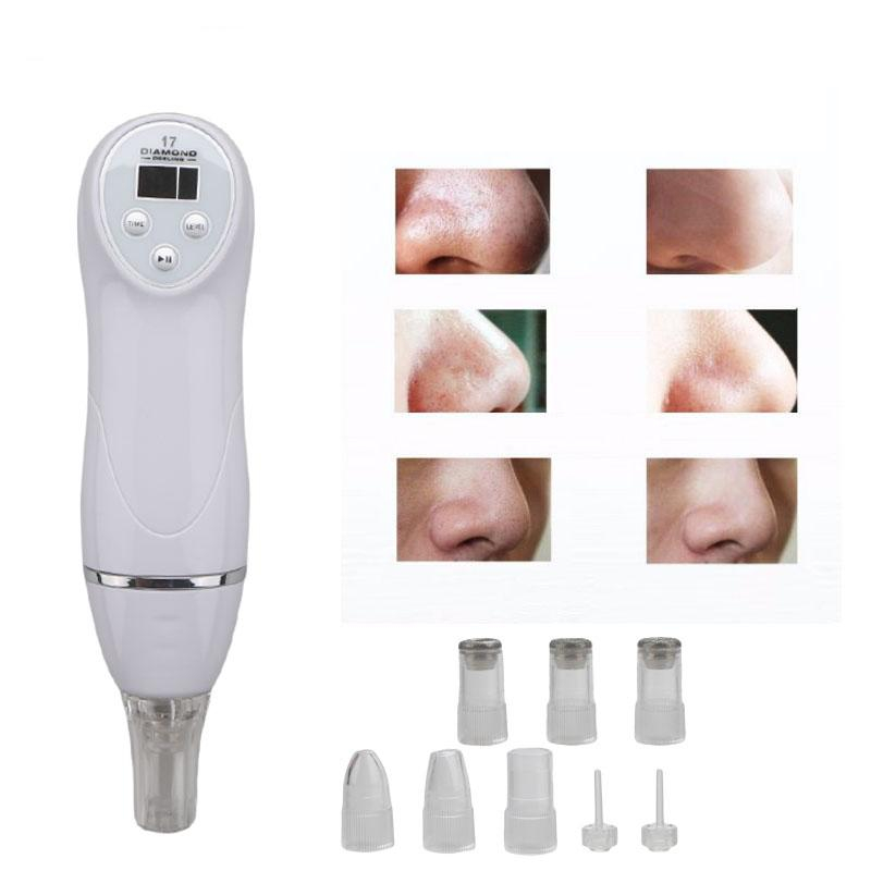 Personal Home Diamond Peel Microdermabrasion Machine