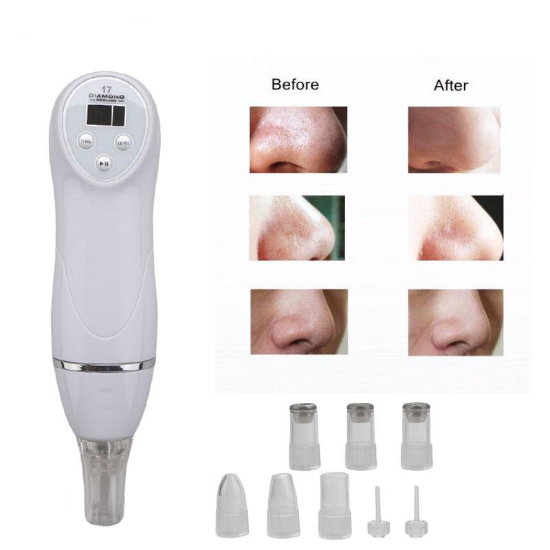 Personal Home Diamond Peel Microdermabrasion Machine