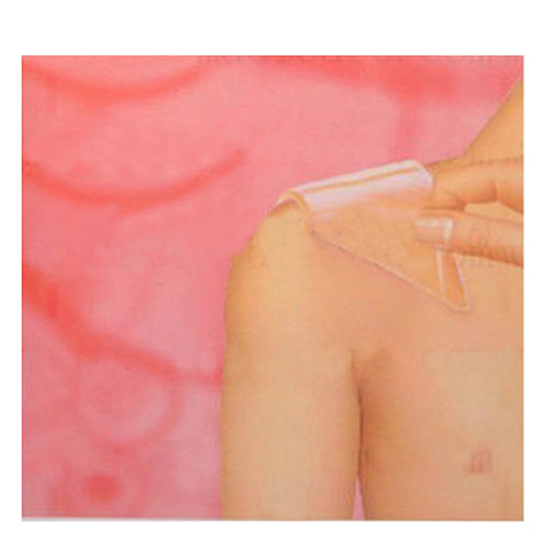 Silicone Patch Scar Removal