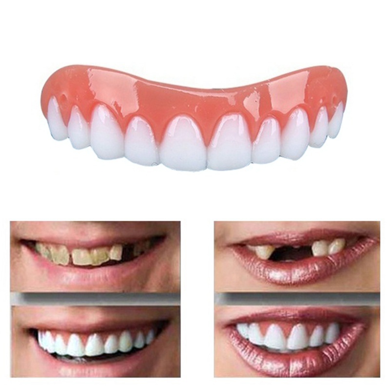 Reusable Veneer Teeth-Front Veneer Teeth