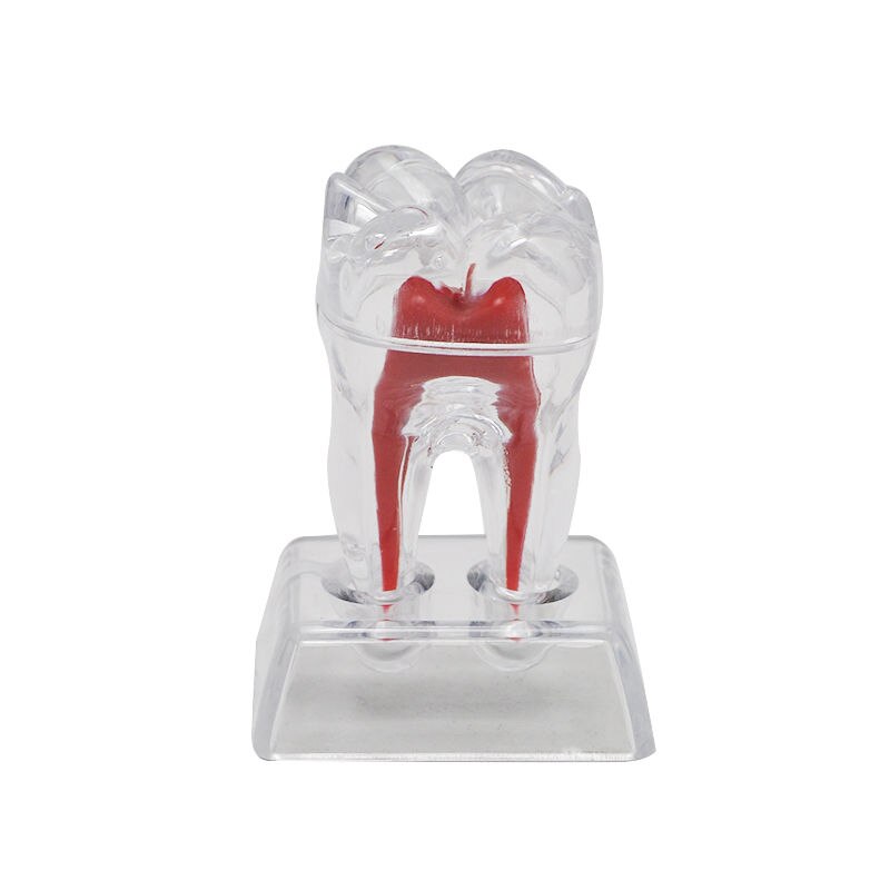 Tooth Model with Crystal Stand