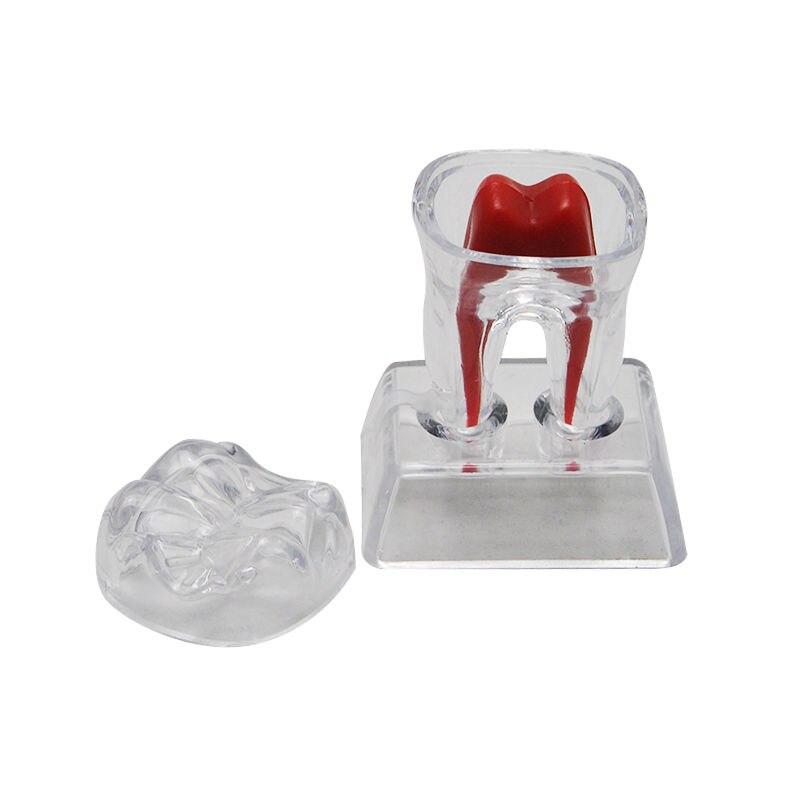 Tooth Model with Crystal Stand