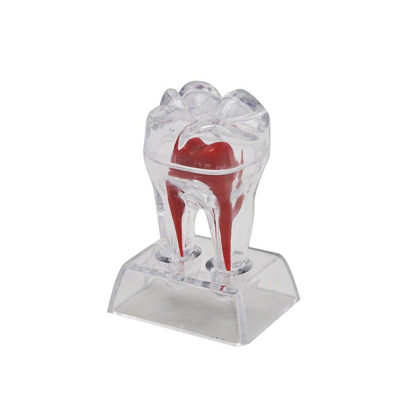 Tooth Model with Crystal Stand